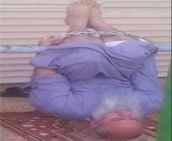 شکنجه‌های زندانیان سعودی +تصاویر(18+)