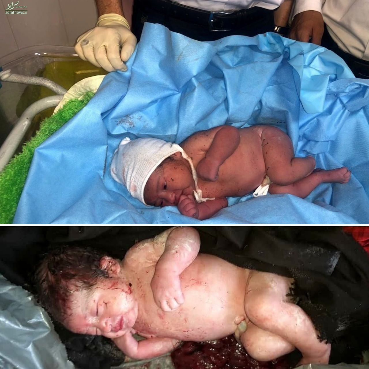 تصاویر/ نوزاد پیدا شده در یکی از سطل‌‌های زباله پایتخت
