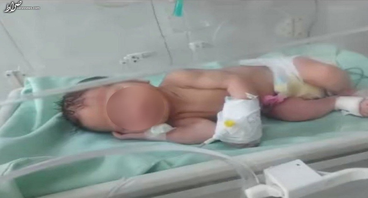 تازه‌ترین وضعیت نوزاد پیدا شده در سطل زباله نازی آباد