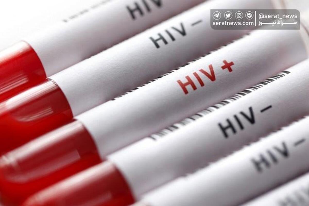 وجود ۲۳۹۰۲ مبتلا به HIV در ایران/روابط جنسی علت 54 درصد موارد ابتلا به HIV‌ در ایران