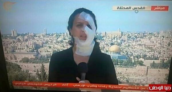عکس|بلایی که اسرائیل بر سر یک خبرنگار زن آورد!